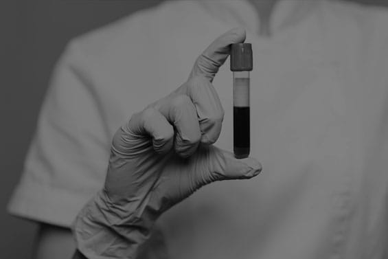 Image hover effect image