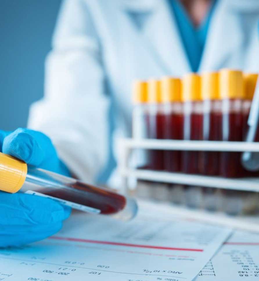 At-home blood testing